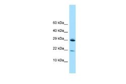 RPL28 Rabbit anti-Human, Polyclonal, Novus Biologicals 0.1ml; Unconjugated:Antibodies,
